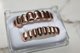 Silver or Rose Gold - Full Mouth Grills (Plated) -  Water Moulded